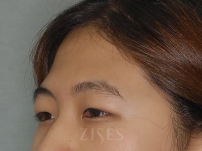 ���� ���� ����