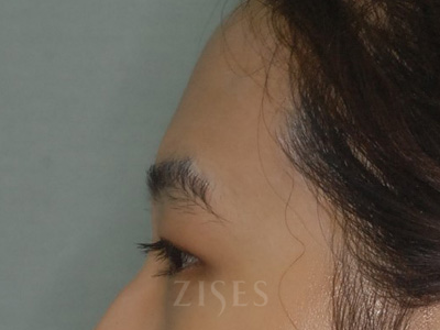 ���� ���� ����