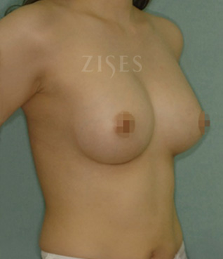 �������� ���� ����