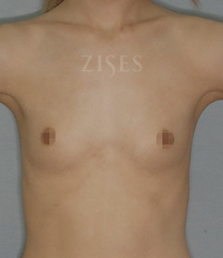 �������� ���� ����