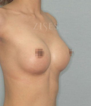 �������� ���� ����