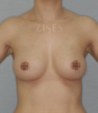 �������� ���� ����