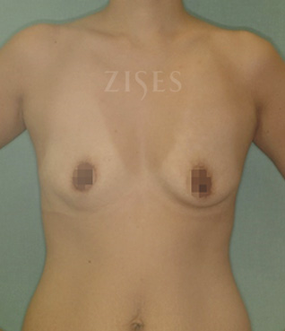 �������� ���� ����