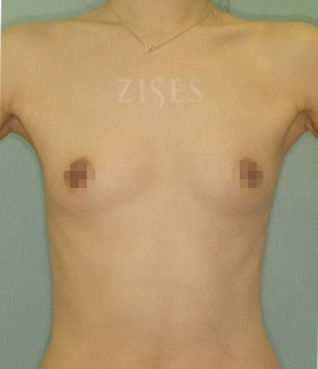 �������� ���� ����