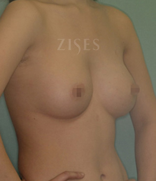 �������� ���� ����