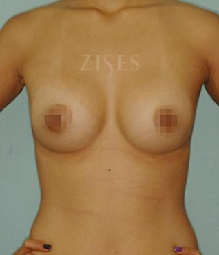 �������� ���� ����