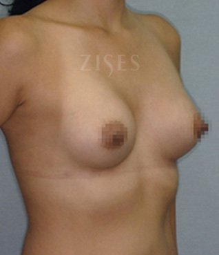 �������� ���� ����