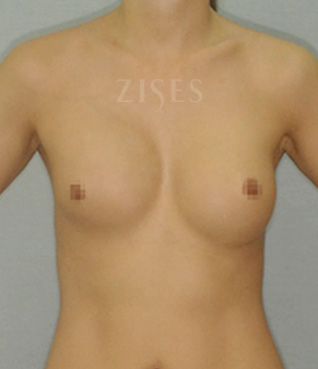 �������� ���� ����