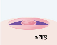 ���� ����