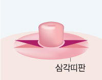 ���� ����