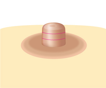 ���� ����