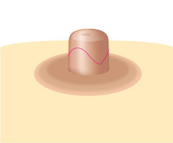 ���� ����