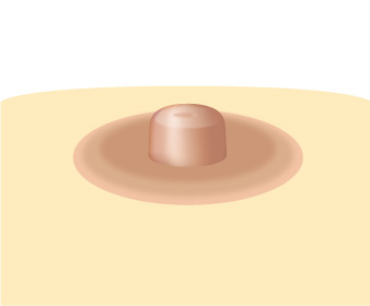 ���� ����