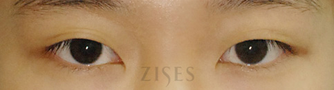 ���� ���� ����