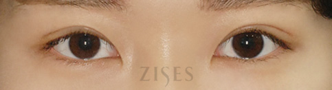 ���� ���� ����