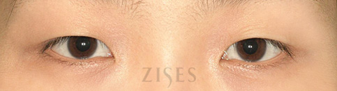 ���� ���� ����