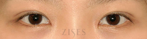 ���� ���� ����