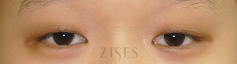 ���� ���� ����