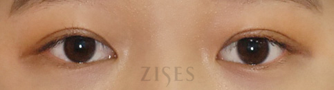 ���� ���� ����