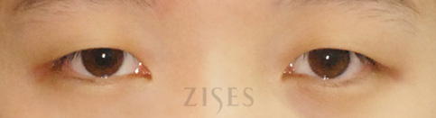 ���� ���� ����