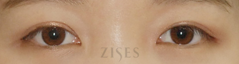 ���� ���� ����