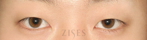 ���� ���� ����