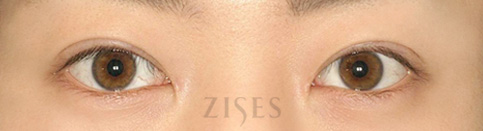 ���� ���� ����