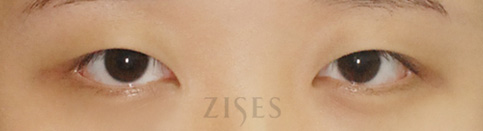 ���� ���� ����