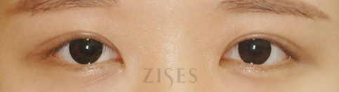 ���� ���� ����