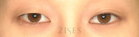 ���� ���� ����