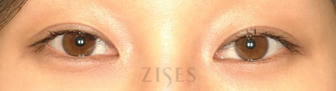 ���� ���� ����