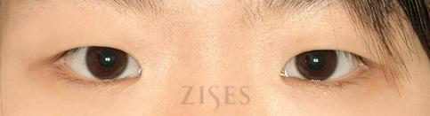 ���� ���� ����