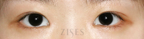 ���� ���� ����