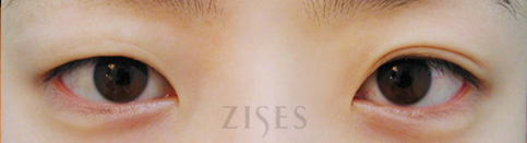 ���� ���� ����