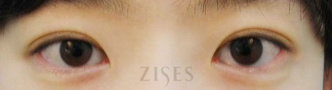 ���� ���� ����