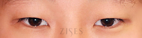 ���� ���� ����