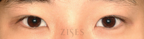 ���� ���� ����