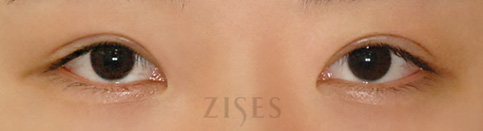 ���� ���� ����