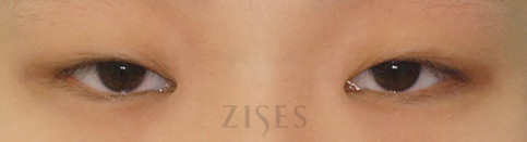 ���� ���� ����