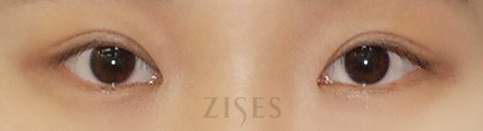 ���� ���� ����