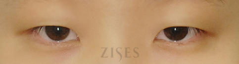 ���� ���� ����