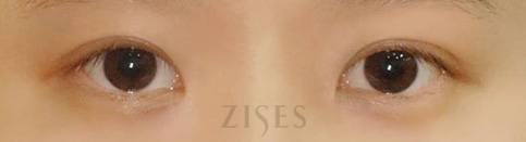 ���� ���� ����