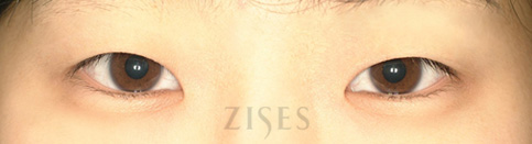 ���� ���� ����