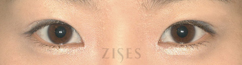 ���� ���� ����