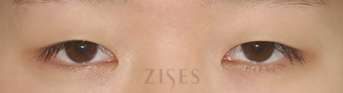 ���� ���� ����