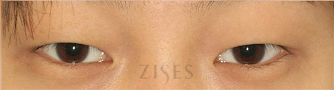 ���� ���� ����