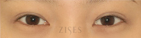 ���� ���� ����