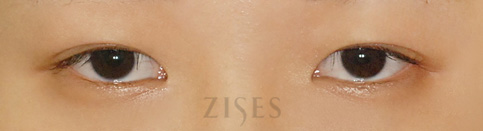 ���� ���� ����