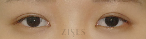 ���� ���� ����