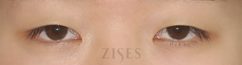 ���� ���� ����